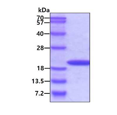 SDS-Page: Recombinant Human Cyclophilin A His Protein [NBC1-18425] - 3ug by SDS-PAGE under reducing condition and visualized by coomassie blue stain